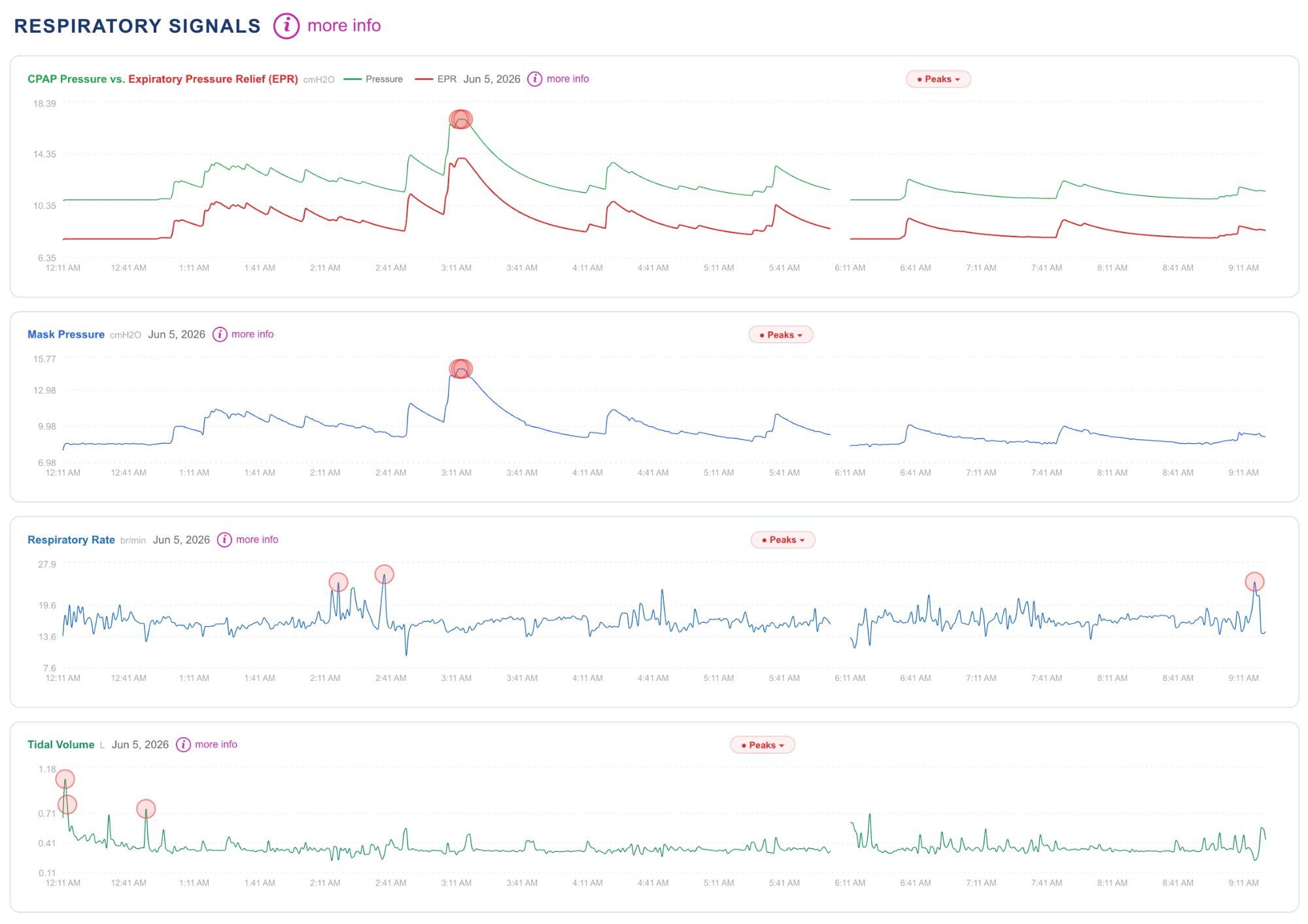CPAP data charts showing AHI, events, leak, and pressure over a night